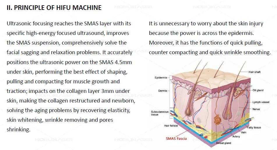 3D Portable Hifu Face Lifting Slimming Machine Beijing Noble Laser