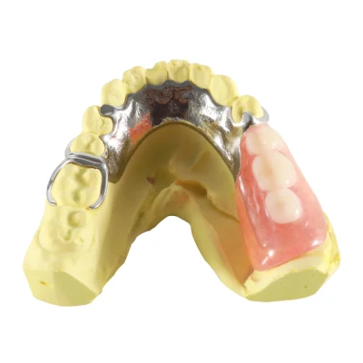 Impressora 3D odontológica @ Chamlion Laser